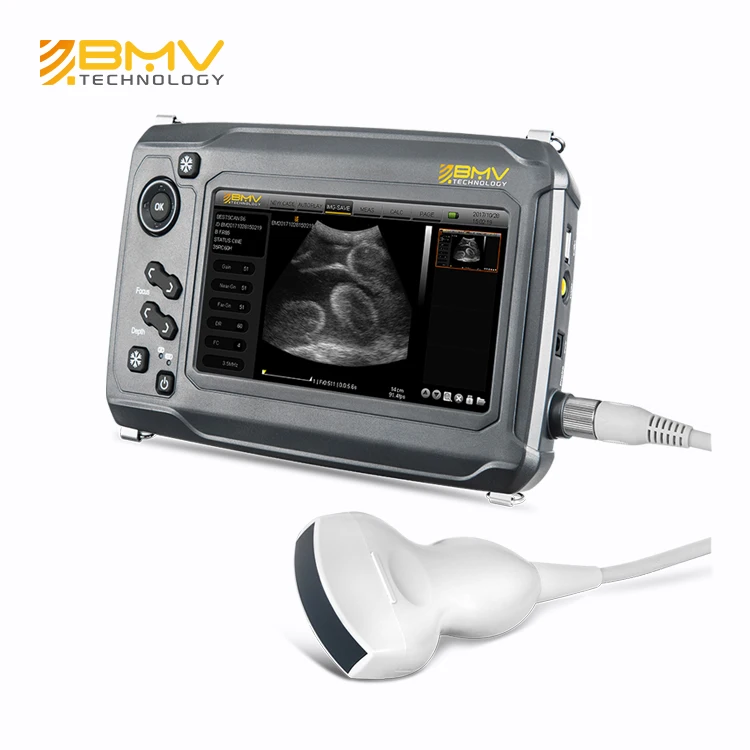 Veterinary Ultrasound Scanner W1/W2 Wireless B Mode Probe –