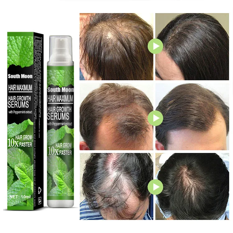 ml6183 Hair Growth Spray, Mint-infused, Nourishing