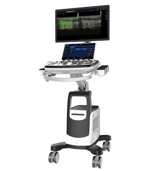 CE approved Chison Cbit 6 5D Cart Color Ultrasound Gynecology,Cardiovascular Chison ultrasound machine