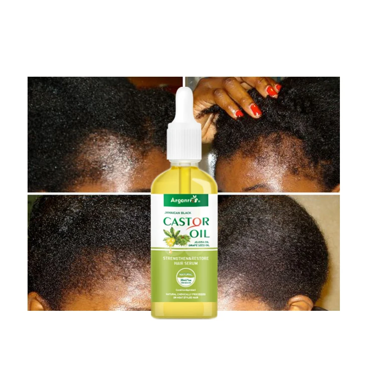 Fast Shipping New Arrival Contain Biotin Jamaican Black Castor Oil Ingredient Golden Hair Growth Oil
