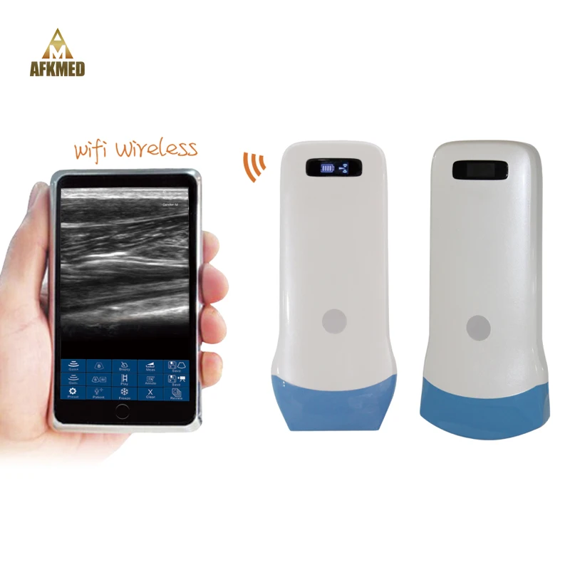 Portable wireless ultrasound probe WIFI Wire array wireless probe handheld ultrasound probe scanner machine