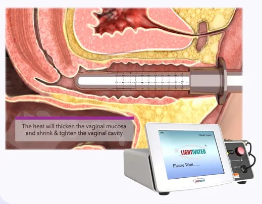 Vaginaning tami yaxshi Vaginaning tami yaxshi