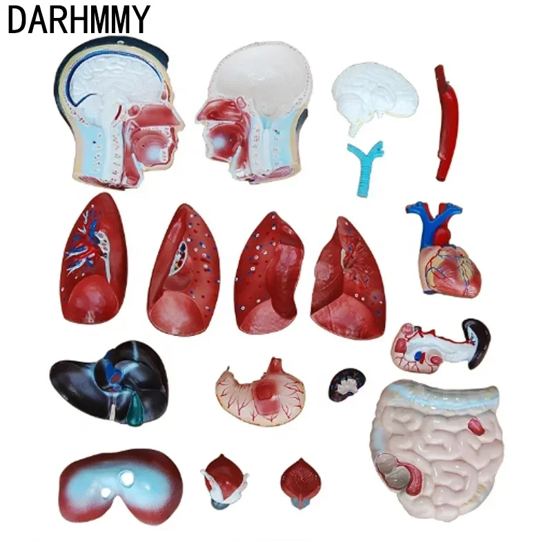 DARHMMY 85CM Male Torso Human Anatomy Simulator with 19 Parts Medical Science Training Product