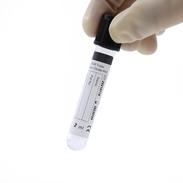 ESR Tube Sodium Citrate Tube for Blood Collection- Pharmaceutical Company