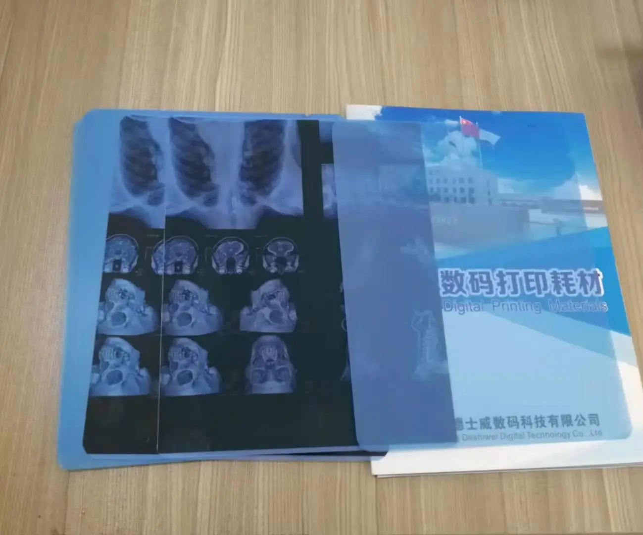 X Ray Digital Inkjet Film  Super Blue  Medical PET Film for Fuji Di Hl  Kodak Agfa Medical X-ray Film for Laser Printers
