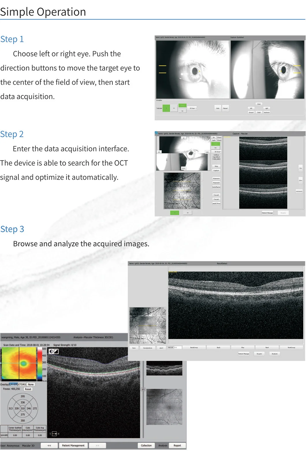 Ophthalmic Touch Screen Automatic Optical Coherence Tomography OCT Scanner Machine