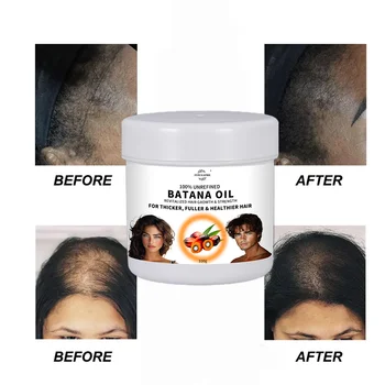 Private Label Hair Growth Oil Natural Organic Hair Repair Reduces Loss Batana Oil For Hair Growth