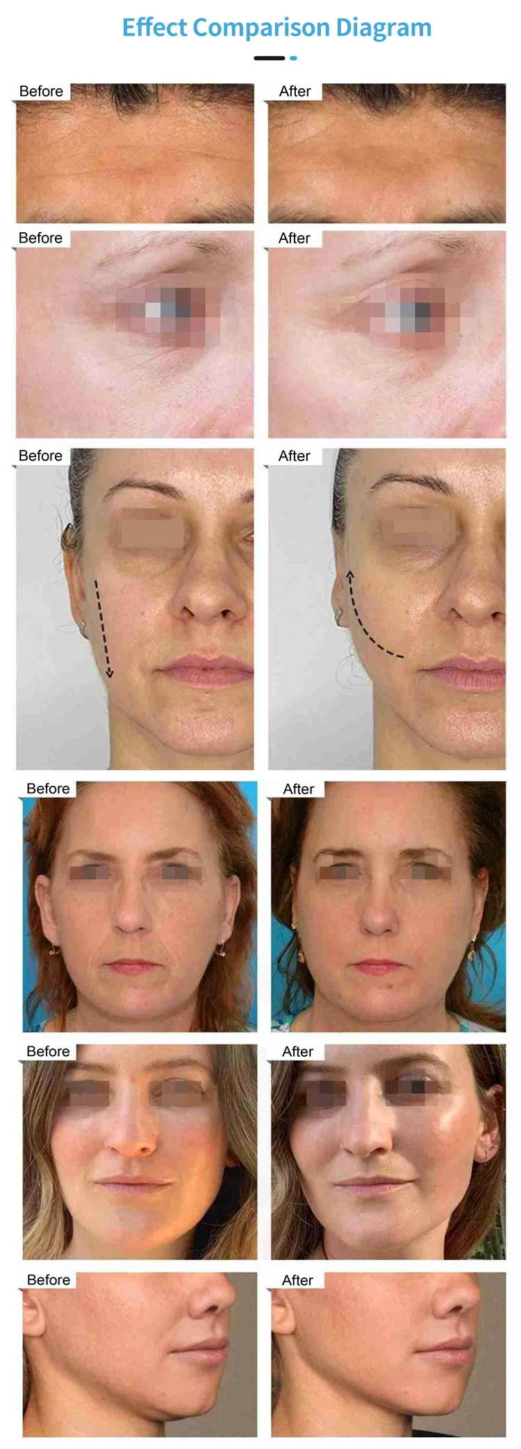 H713746cdf7b948efb377d8fe297ec7487