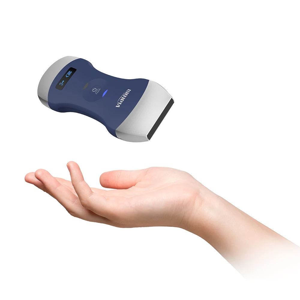 Viatom Mini Wirless High Resolution Ultrasound Scanner - Oxyaider