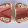 Ensemble complet de dents standard (sans articulateurs)