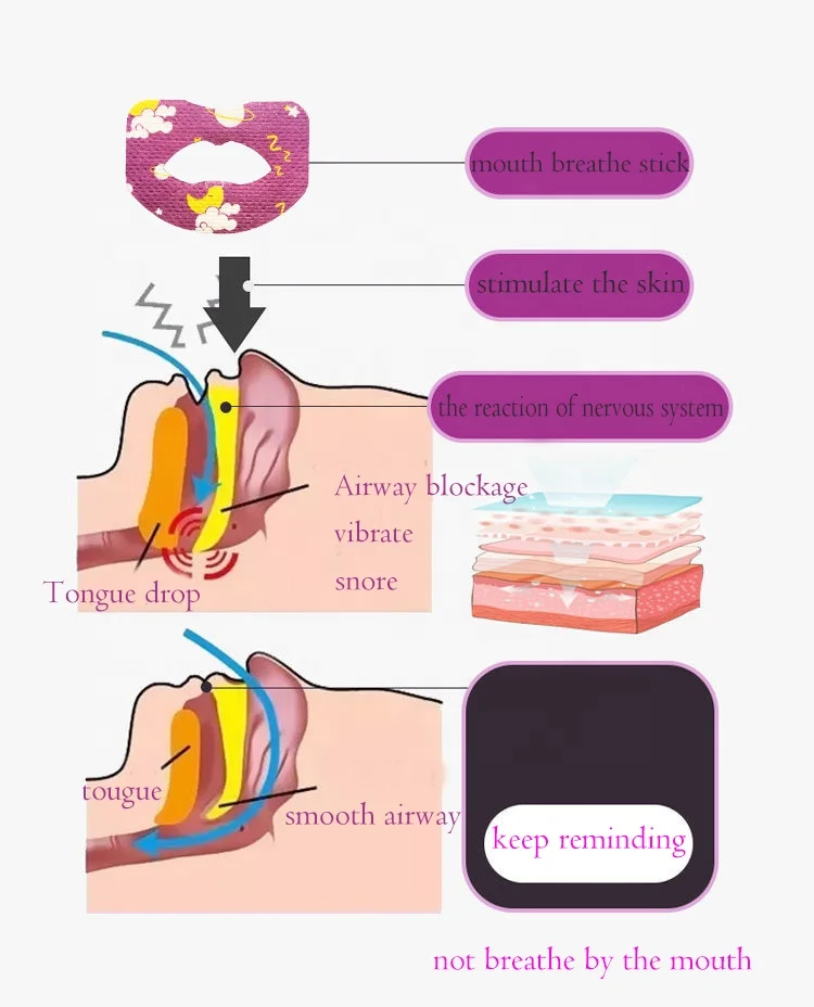 Anti Snoring Advanced Gentle Lip Shape Mouth Tape for Sleeping Stop Snoring for Better Breathing Aids Sleep Strips