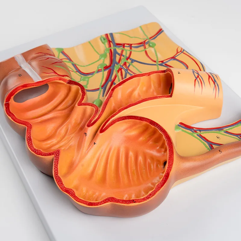 Yulin YL0418 Human Digestive System Anatomical Model Enlarged Rectum ...