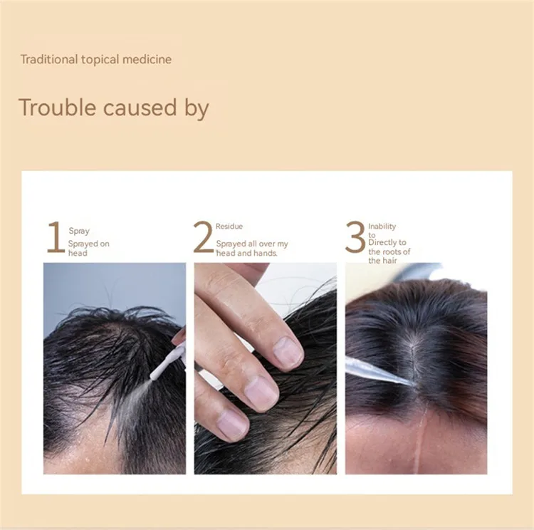 New Arrivals Electric Massage Scalp Massager Brush Hair Growth New Arrivals Electric Massage Scalp Massager Brush Hair Growth