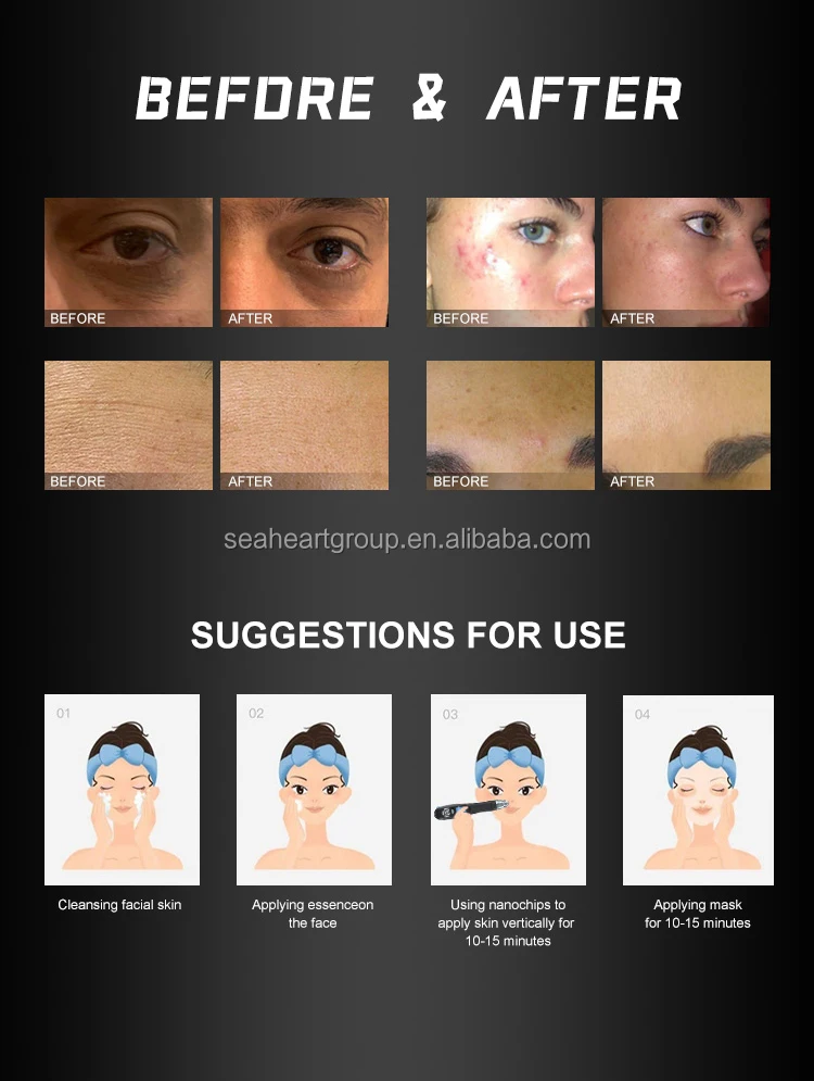 微针dermapen无线真皮笔针纳米针刺epn电穿孔用9/12针微针 - buy