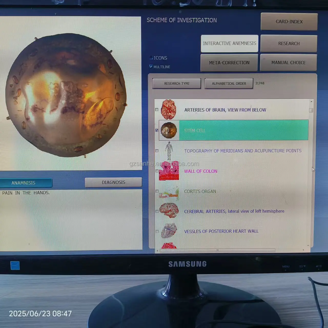 Wholesale CHAKRA 12D NLS Nonlinear Scanner Homeopathy Phytotherapy Meta Correction Vegeto Test Bio Resonance Therapy Machine for