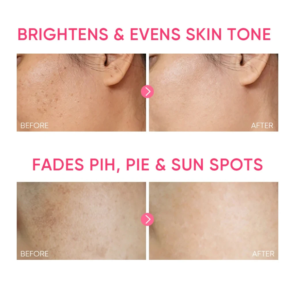 Custom Dark Spot Removing Reduce Redness Lightening MSH Niacinamide Brightening Glowing Moisture Gel Face Cream and Lotion