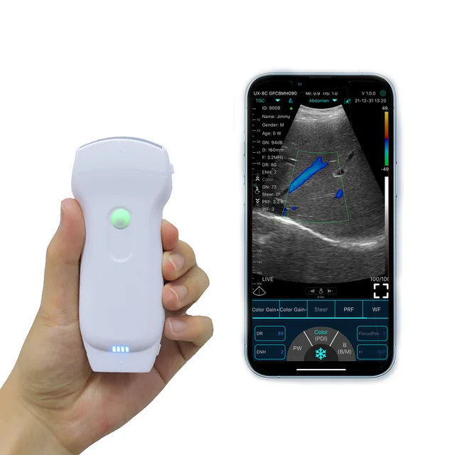 C10RL Linear and Cardiac Color Doppler Ultrasound Scanner Ultrasound with Probe Handheld Ultrasound