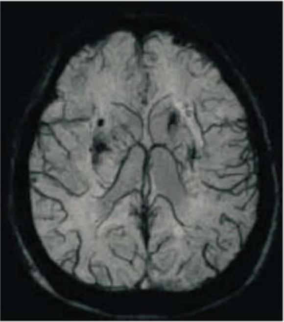 Hospital Medical Magnetic Resonance Imaging System 1.5T  MRI Machine with A-combi and Al Technologies factory