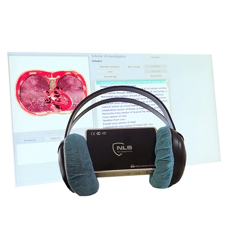 High Accuracy Body Check Machine 17d Nls Meridian Therapy Instrument Health Analyzer