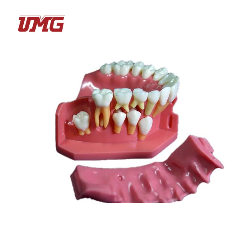 Baby Teeth Primary and Permanent Alternate Anatomical Model