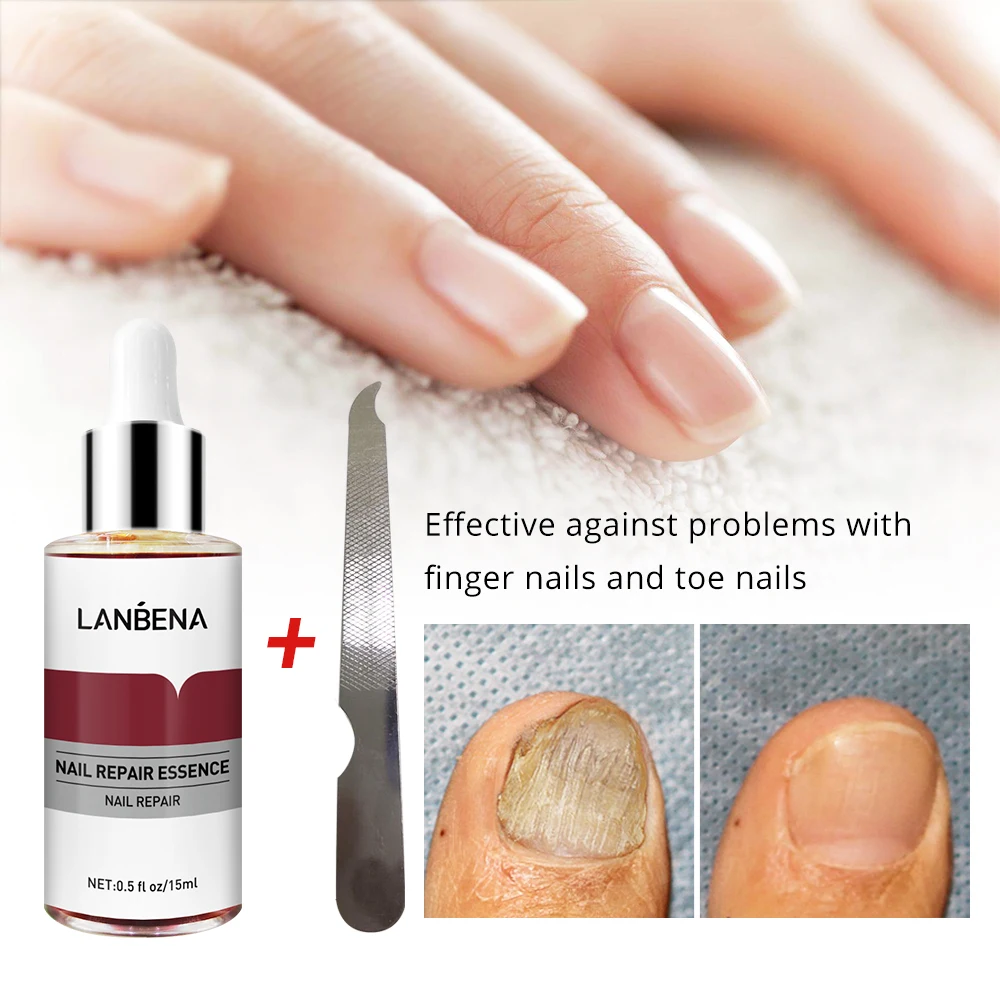Средство от грибка ногтей LANBENA Nail Repair Essence 15 ml