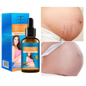 Mark Private Label Best Seller Organic Anti Strong Anti-Stretch Serum Oils for Pregnancy Skin and Stretch Marks Removal Oil