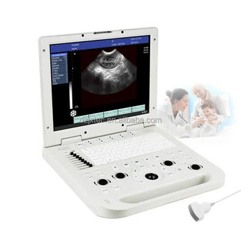 Better Price Ultrasound Human And Vet Full Digital Laptop Ultrasound Medical Portable Medical Ultrasound Instruments