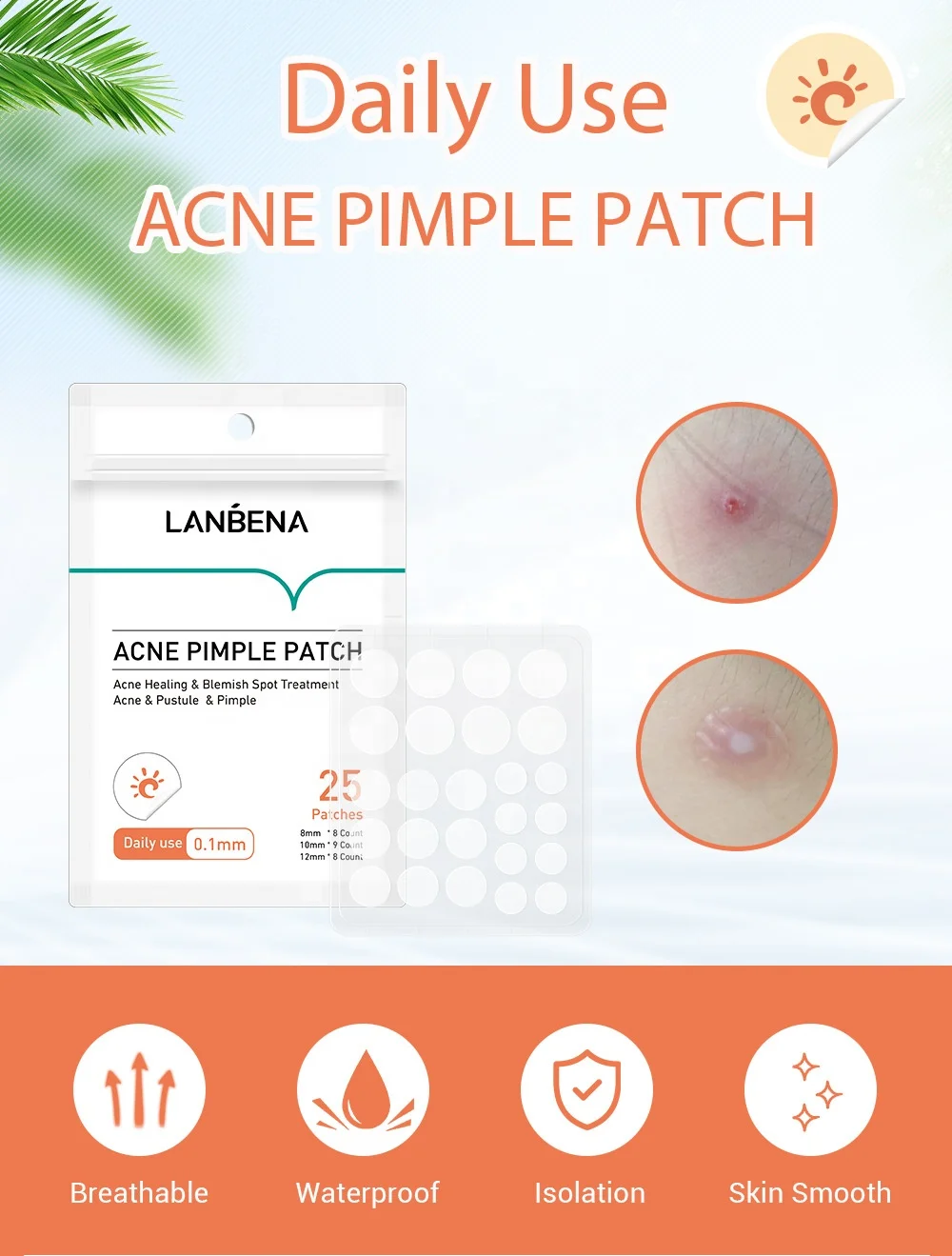 LANBENA Acne Pimple Patch 25pcs Daily Use Invisible Acne Stickers Blemish Treatment Acne Master Beauty Tool Skin Care