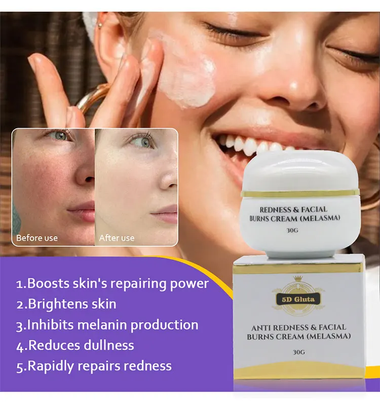 Strong Effective Skin Lightening Reduce Redness Burn Face Face ...