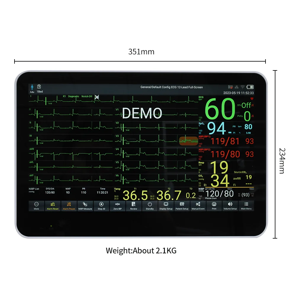 CONTEC CMS8500 Multiparameter Portable Vital Sign Monitor Cardioc Patient Monitor
