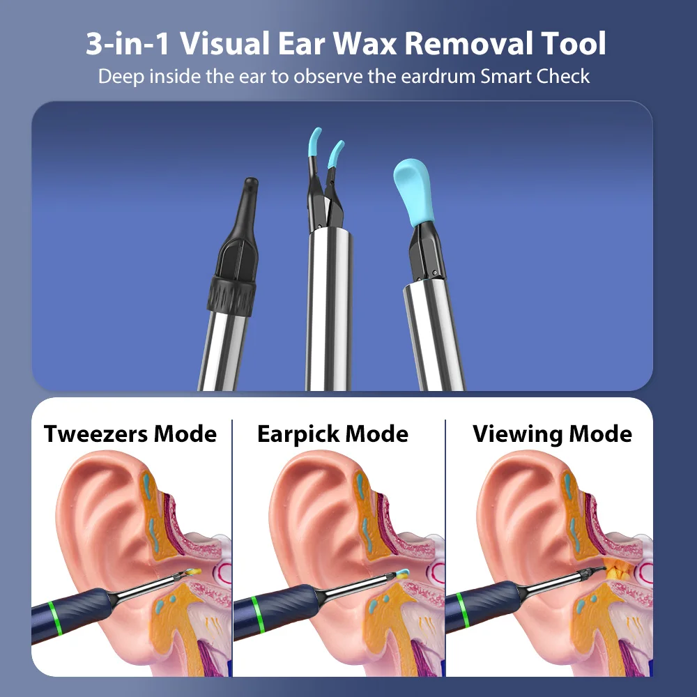 Bebird Note5 Pro Oral Camera Dental Smart Tweezers Earwax Removal Tool