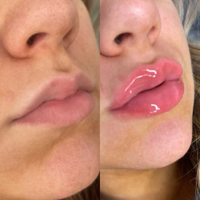 what is the difference between lipo b and lipo c 💉Lipo-B vs Lipo-C💉 Interested in using one of our lipo injections but  unsure which one is right for you? Let's break it down! Lipo-B is a  combination of lipotropic nutrients + vitamin