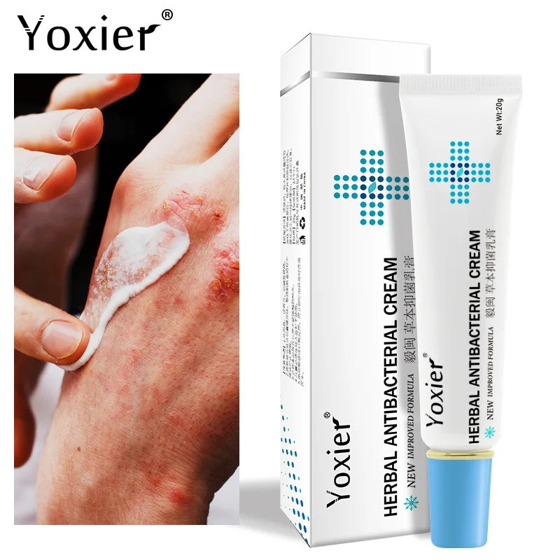 Yoxier Hand Foot Anti Itch Rash Urticaria Psoriasis Treatment Cream For