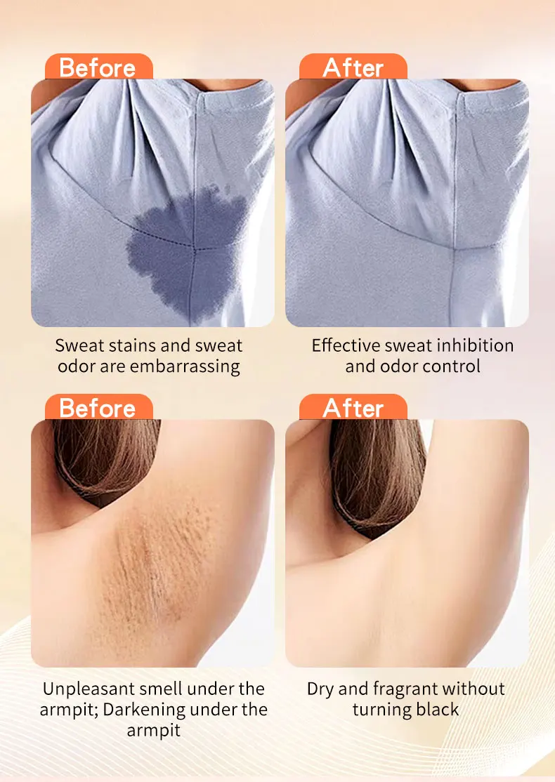 For DR RASHEL Advance Quick Dry Roll-on Antiperspirant Deodorant 48h Anti-Sweat & Odour Protection Solid Form Armpit Whitening