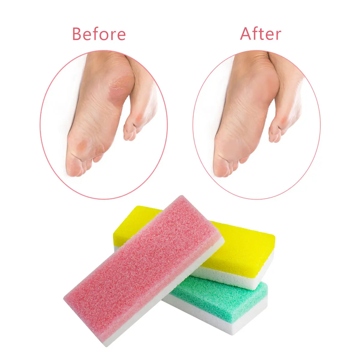 Salvmary Foot Scrubber Sponge Buffer Pad Callus Remover for Feet