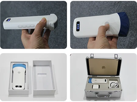 OEM Double Head Linear Small Linear Micro Convex Portable Wireless Mobile Phone Ultrasound Scanner