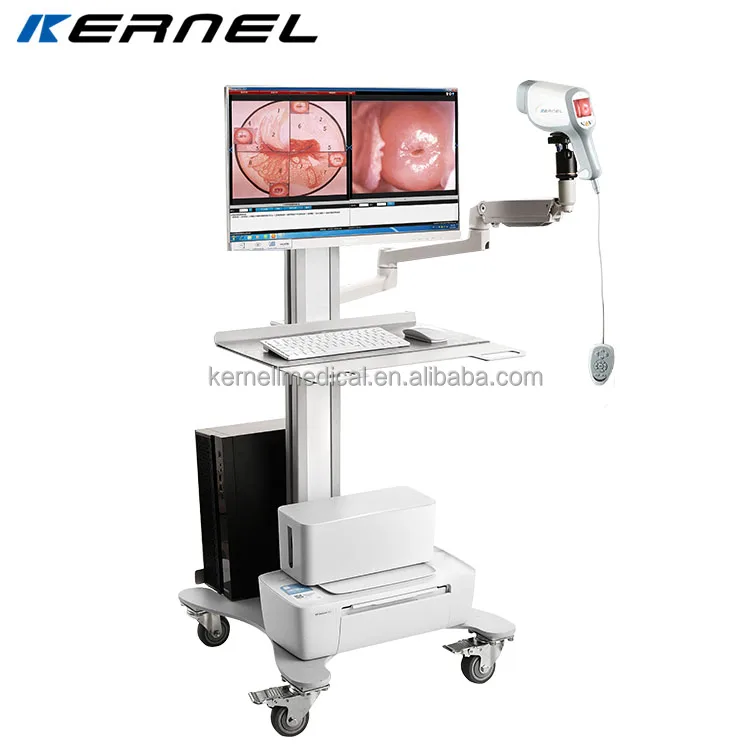 Kernel Colposcopy Examination Surgical Instruments Full hd Camera Colposcope Price Equipment for  Gynecology with Software