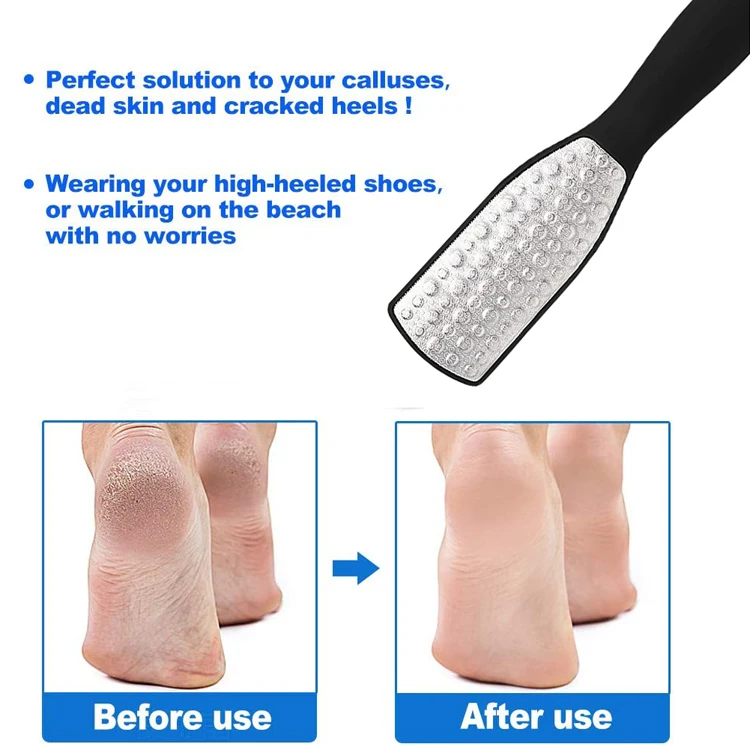 product factory hot sale foot file callus remover plastic stainless steel foot file-4
