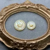 Gold (Cancer)