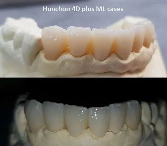 Full Arch CAD CAM System 4D Plus Multilayer Zirconia