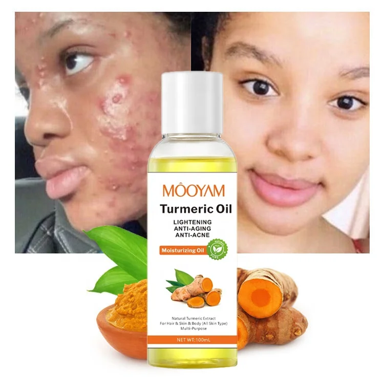 customized-turmeric-oil-face-whitening-lightening-acne-dark-patches