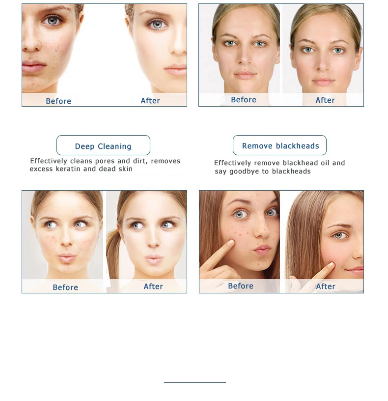 Little Bubble Facial Beauty 6 Handle Whitening Skin Rejuvenation LED Mask Oxygen Deep Cleaning Machine