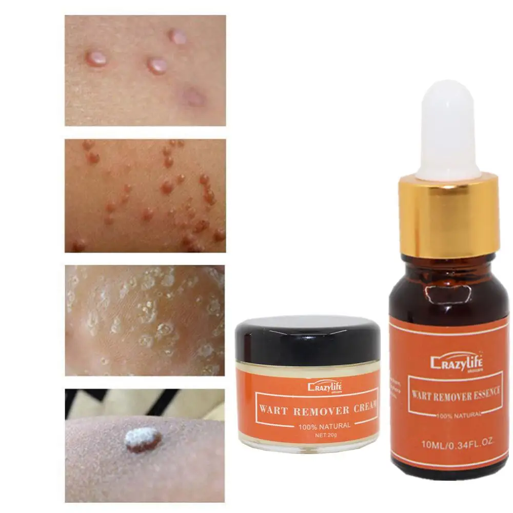 
Крем для лечения бородавок на теле, средство для удаления бородавок на ногах, мазь для ухода за ногами 