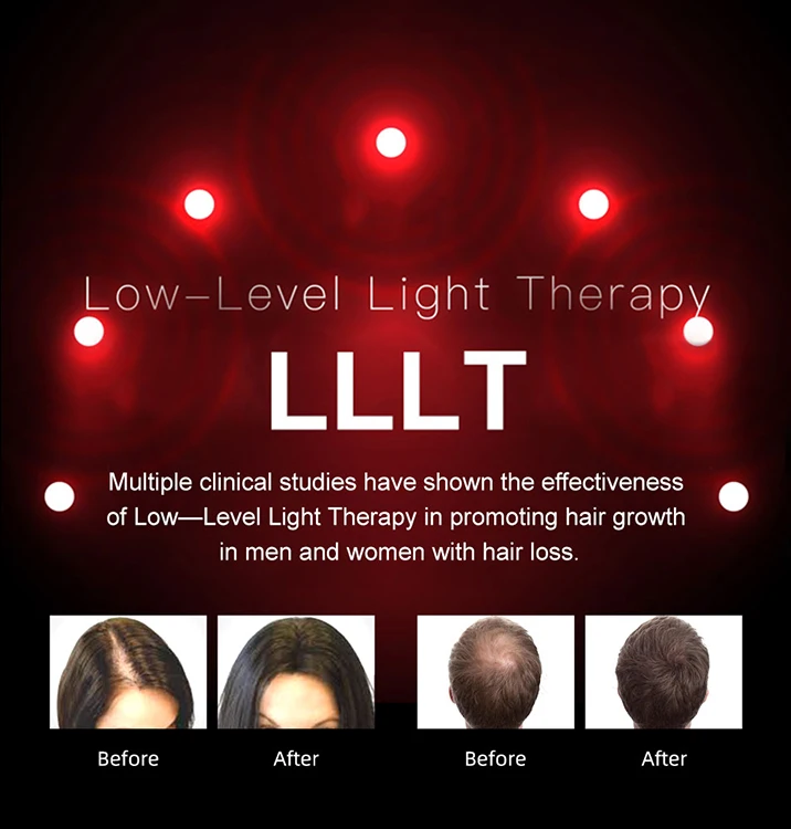 Хит продаж, 2024 лазерный шлем для роста волос