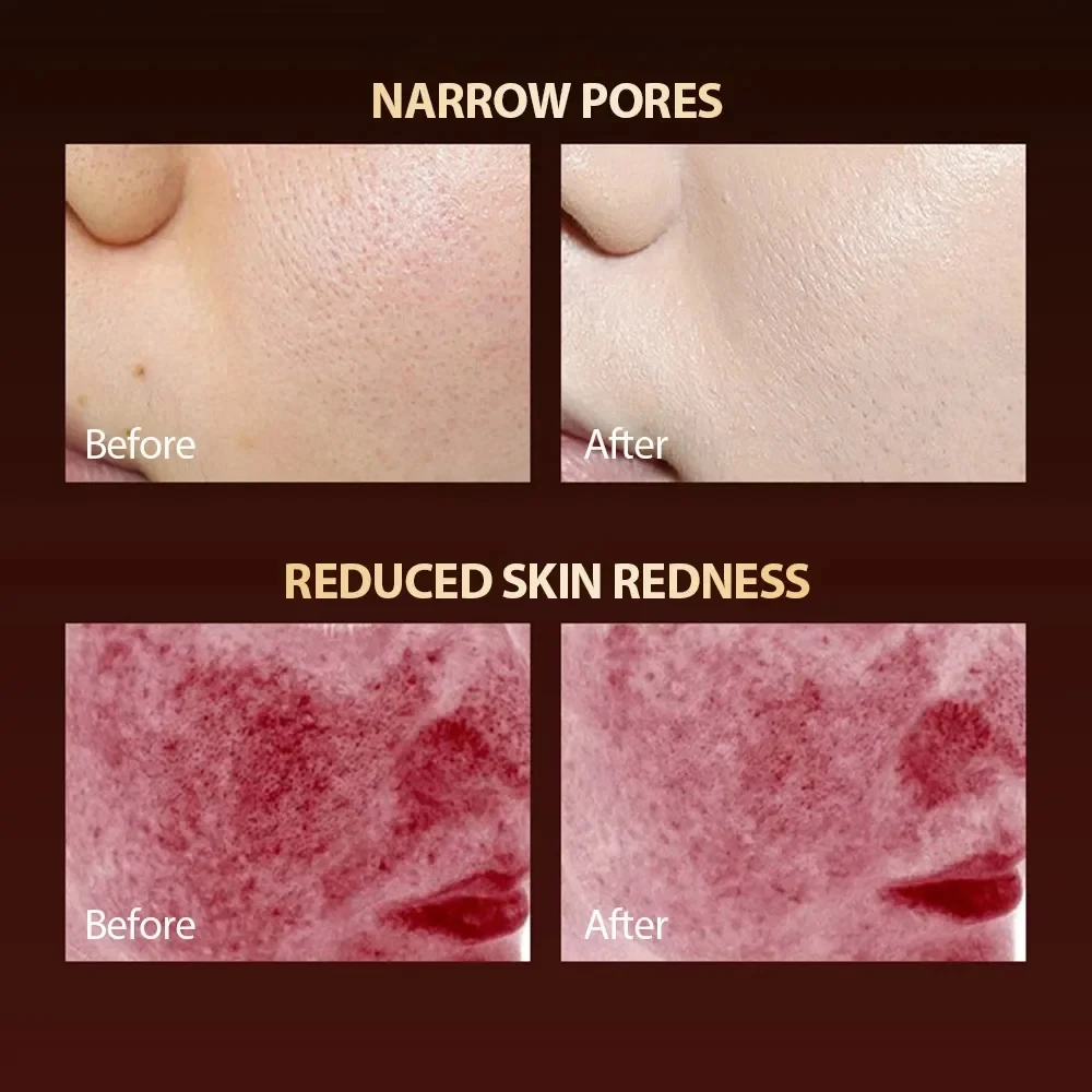 Beauty Device 2024 LED Red Light Therapy Face Mask 7 Colors Photon Radio Frequency Skin Rejuvenation Tightening Skin Care Tool