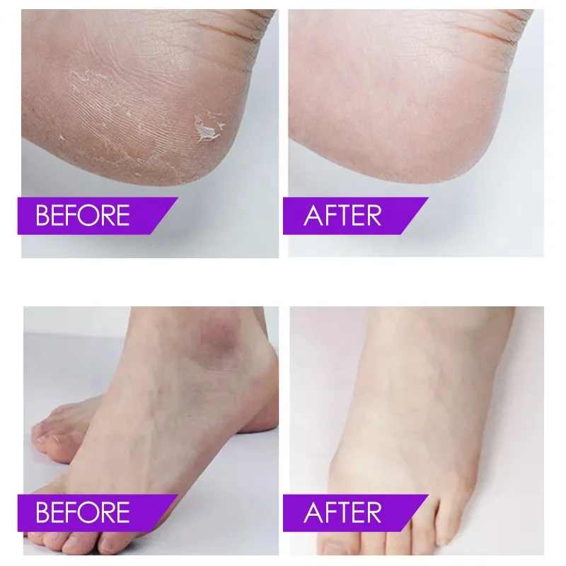 OEM Private Label SPA Relaxing Pure Nature Herbal Lavender Ginger Jelly Feet Soak Pedicure Foot Soak Salts Foot Soaking Powder
