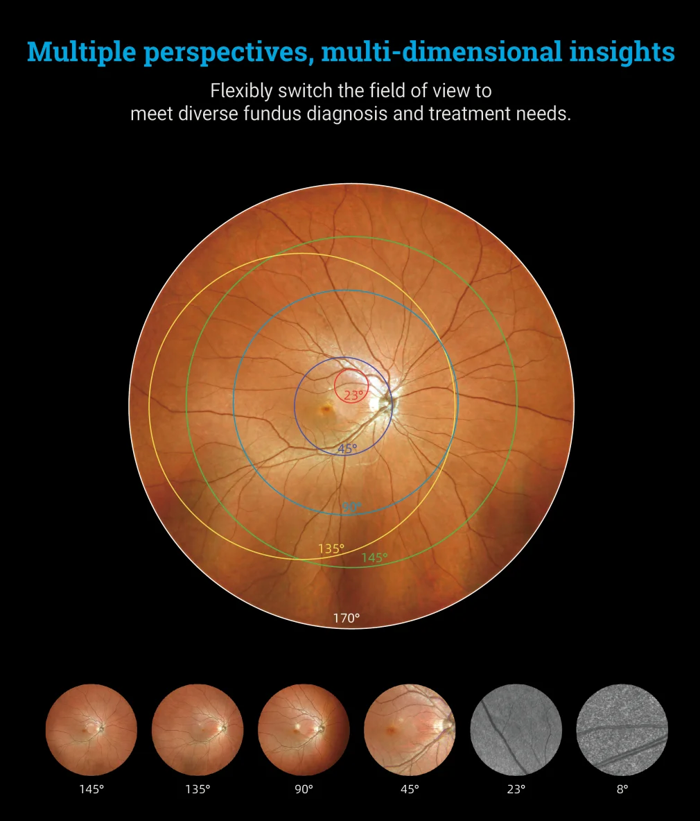 170&deg; Ultra Wide Field Fundus Imaging System Retinal Camera with Four Laser Sources and Automatic Eye Positioning
