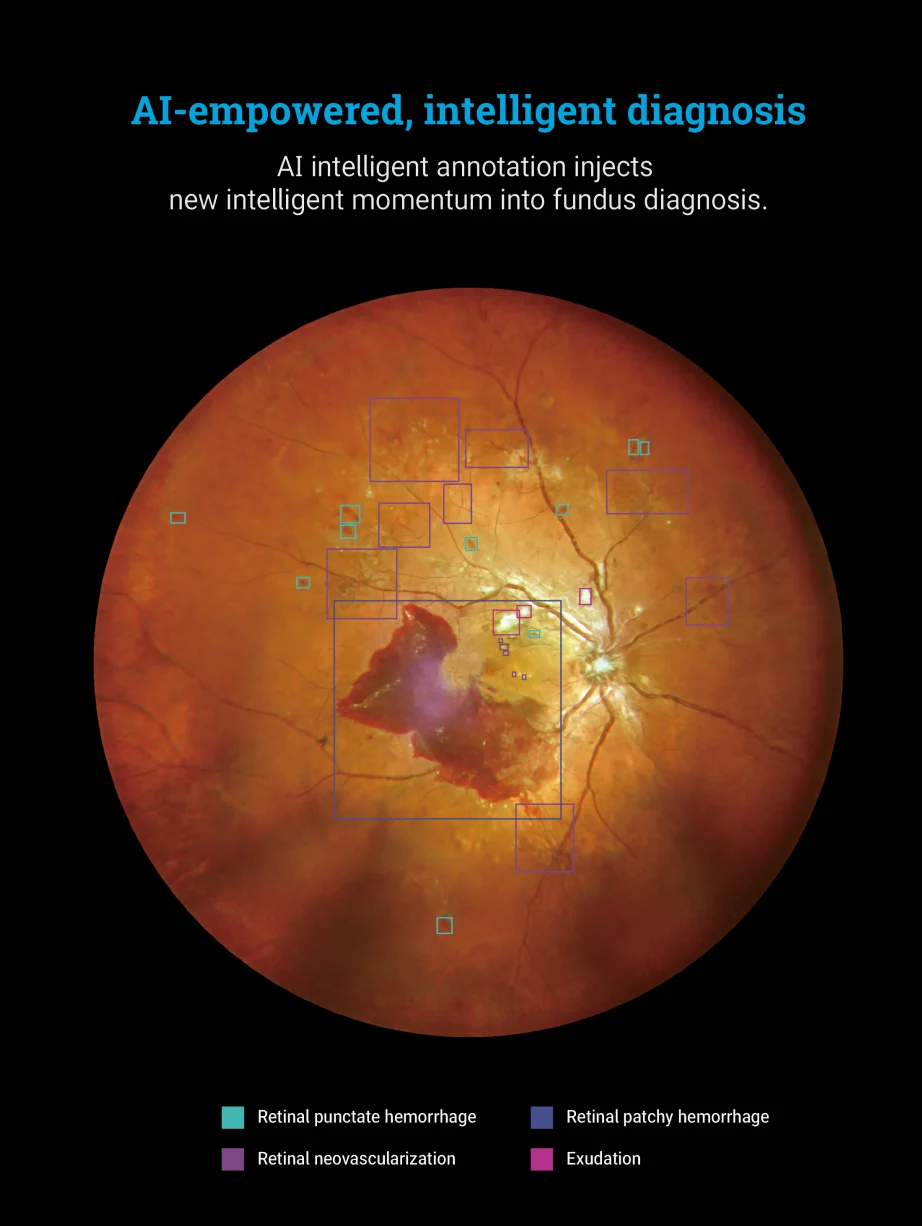 170&deg; Ultra Wide Field Fundus Imaging System Retinal Camera with Four Laser Sources and Automatic Eye Positioning