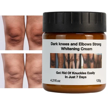 Wholesale Body Care Skin Whitening Creams Anti Dark Spot Wrinkle Knees Elbows White Lotion Moisturizer Body Whitening Cream