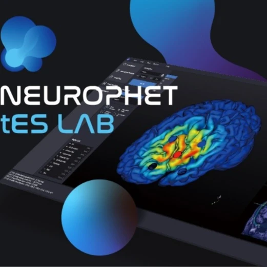 NEUROPHET tES LAB can makes fully automated brain segmentation